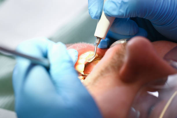 Best Emergency Care for Gum Disease in Forest Hill, TX