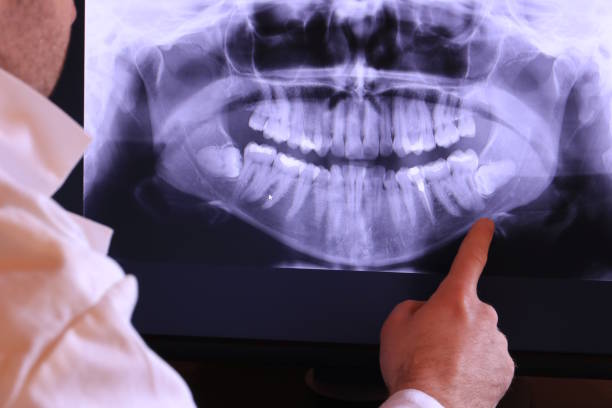 Best Emergency Treatment for Jaw Pain or Injury in Forest Hill, TX