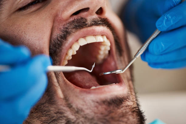 Best Emergency Treatment for Oral Infections in Forest Hill, TX